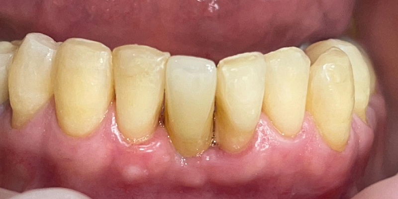 Before Image 13