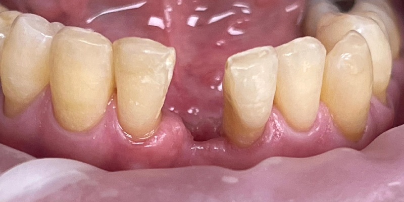 After Image 14