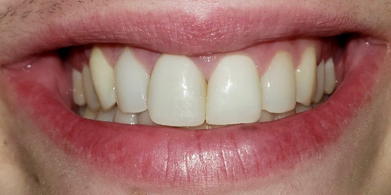 After Image 2