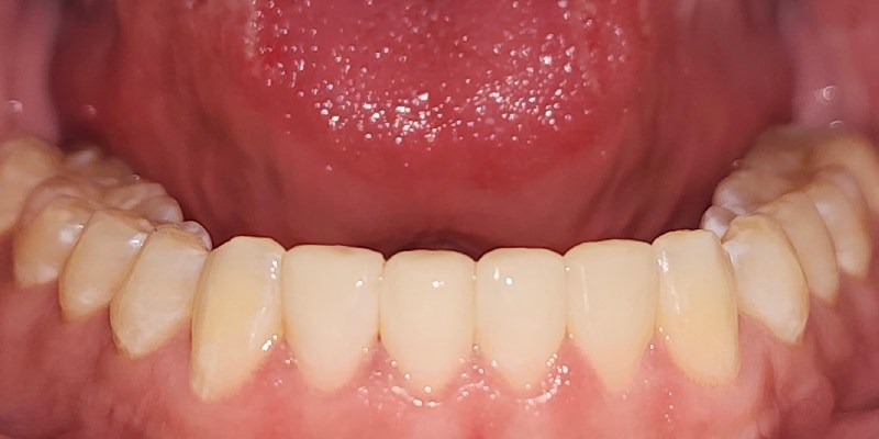 After Image 3
