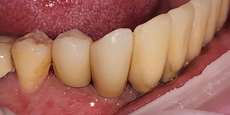 After Image 5