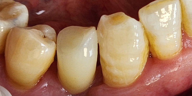 After Image 6