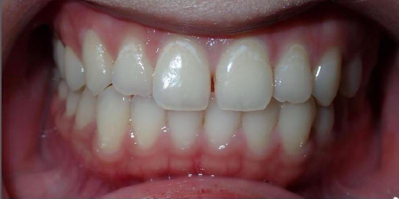 Before Image 1