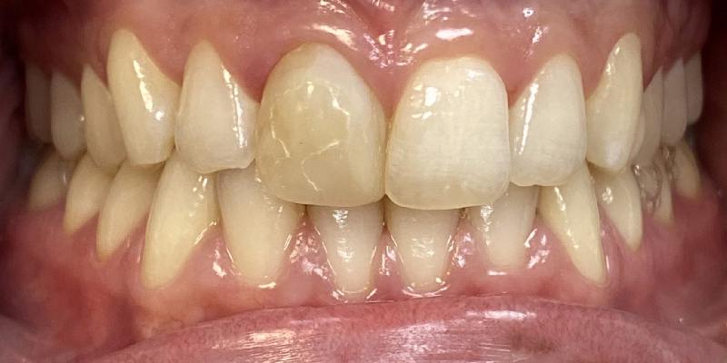 Before Image 2