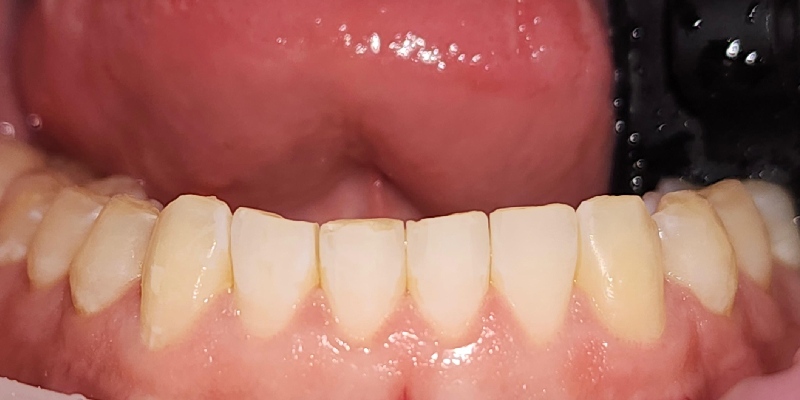 Before Image 3