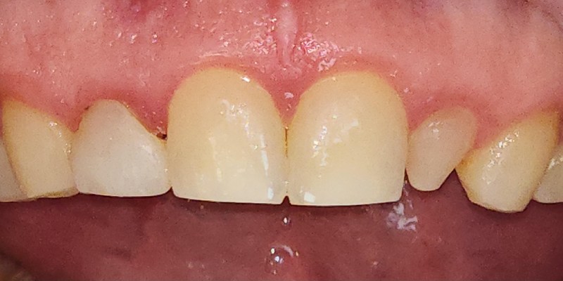 Before Image 4