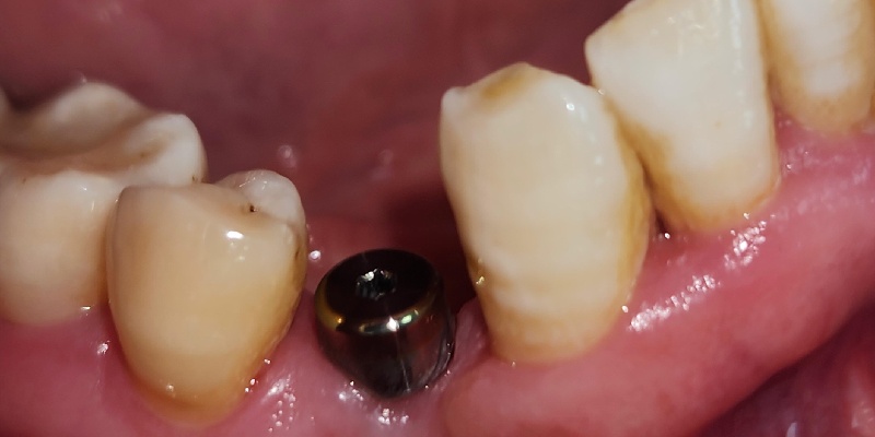 Before Image 6